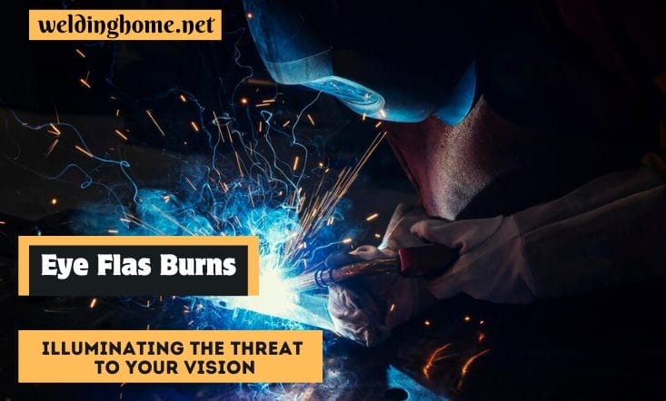Eyes Flash Burns: Illuminating the Threat to Your Vision